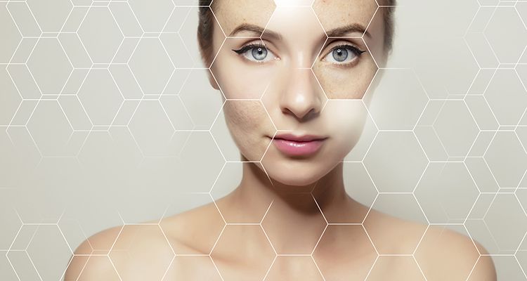collagen